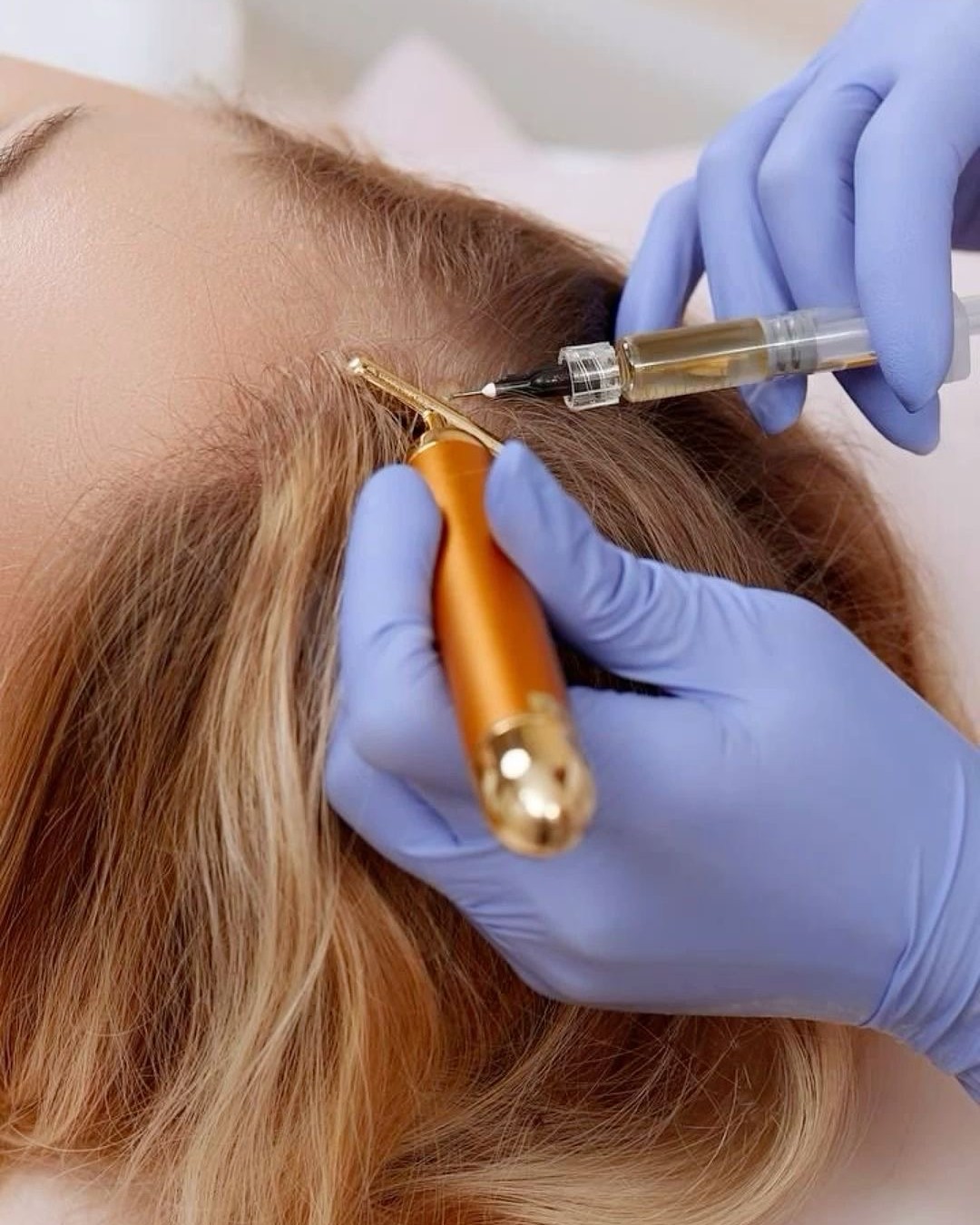 Platelet-Rich Plasma